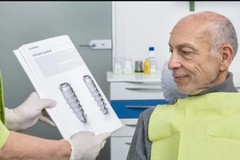 Impianto dentale a Rivoli: quanto incide l’implantologia sull’estetica del volto e del sorriso