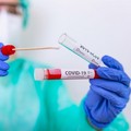 Coronavirus, bollettino epidemiologico regionale del 4 agosto 2021